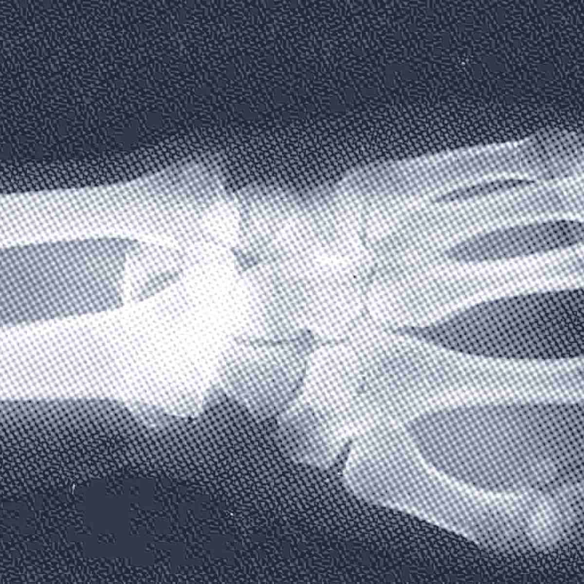 bones