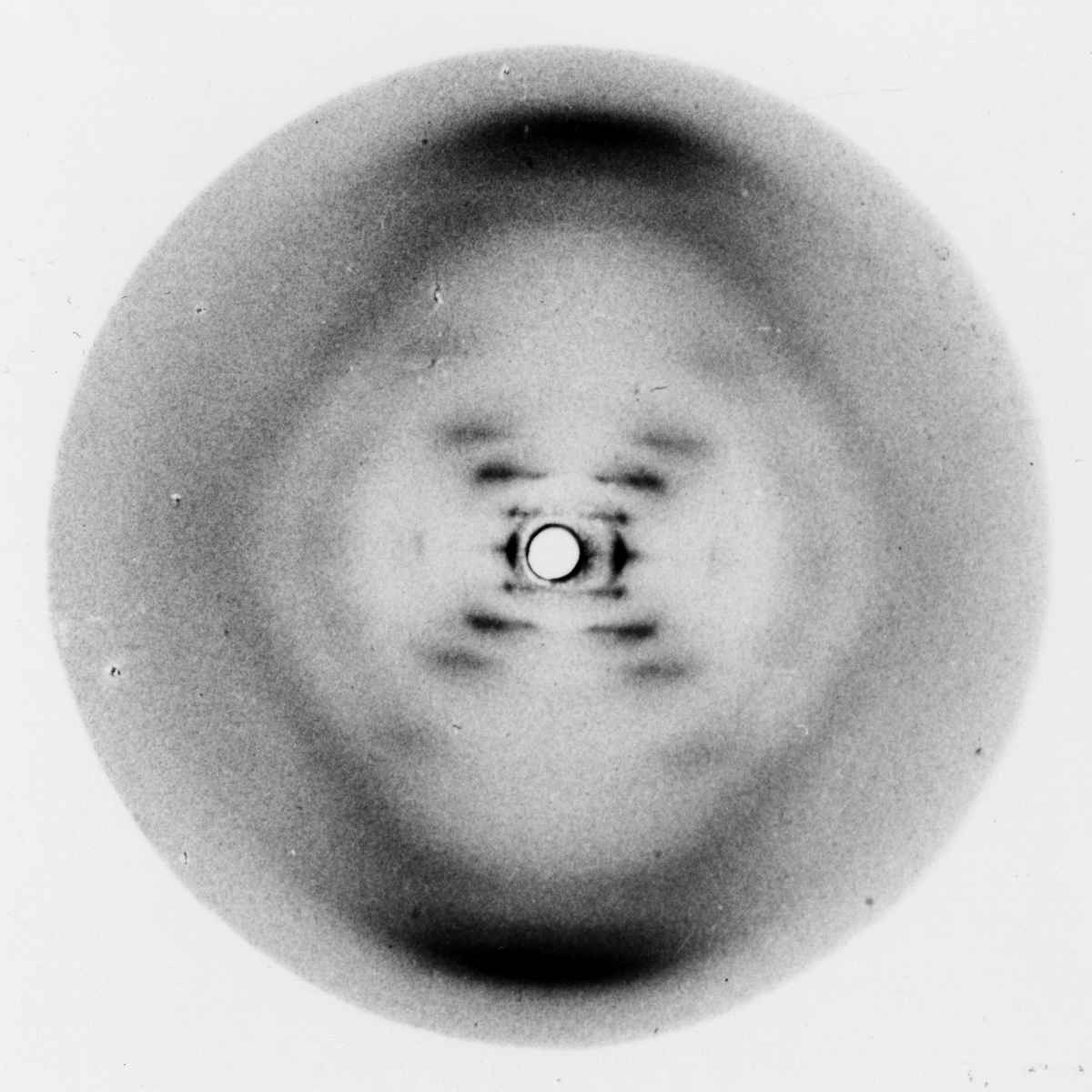 A famosa "fotografia 51" da molécula de DNA