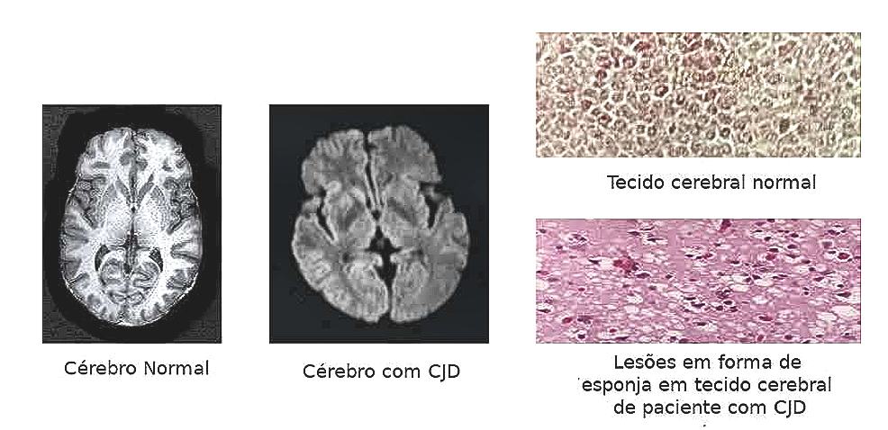 Imagens de tecido cerebral