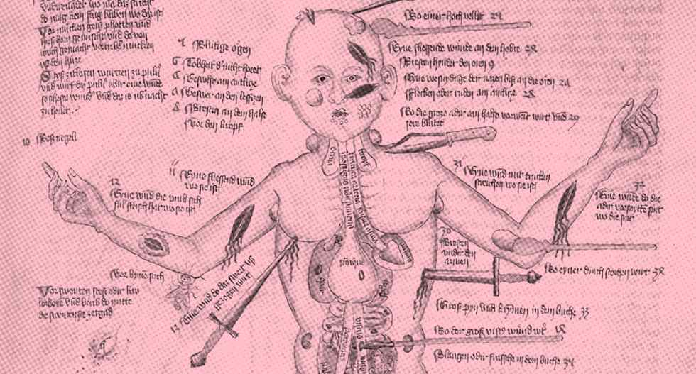 Imagem medieval de homem ferido