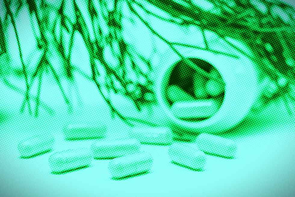 suplementos