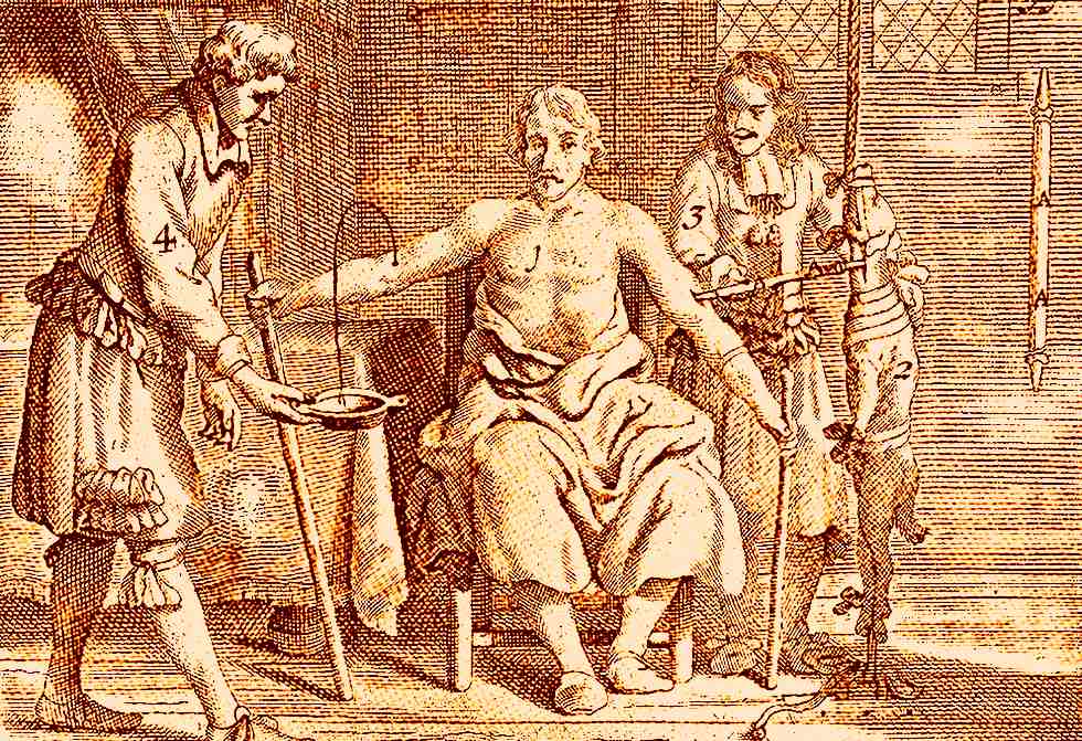 antiga ilustração de transfusão de sangue